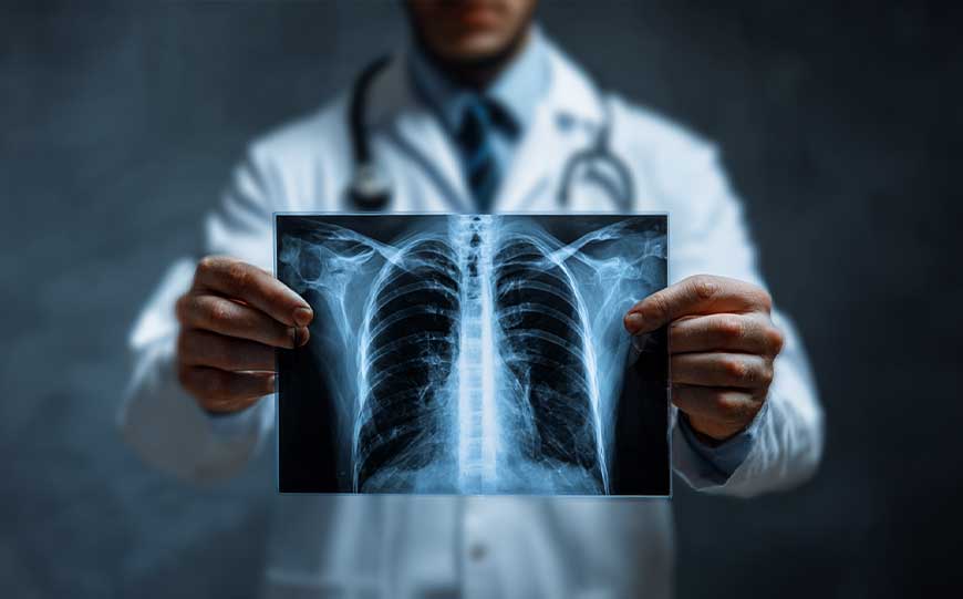 most dangerous asbestos issues
